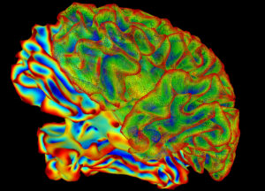 Colourful Brain